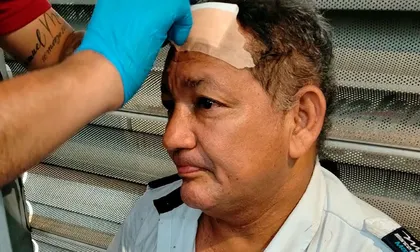 Conductor del MIO recibió una pedrada en la cabeza en Cali por pedir a jóvenes que bajaran del techo de un bus
