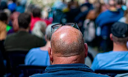 Bebidas azucaradas y energizantes podría aumentar calvicie masculina