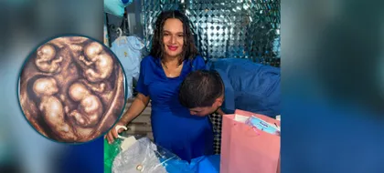 Imagen de  “Dios nos eligió”: Padre de los primeros cuatrillizos varones idénticos que nacerían en Colombia. El embarazo es riesgoso