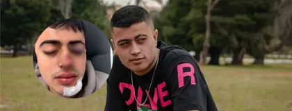 Imagen de  Nuevos detalles del robo y golpiza a un joven tras salir de Provenza: lo llevaron hasta Itagüí y lo abandonaron en La Candelaria
