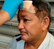 Conductor del MIO recibió una pedrada en la cabeza en Cali por pedir a jóvenes que bajaran del techo de un bus