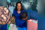 Imagen de “Dios nos eligió”: Padre de los primeros cuatrillizos varones idénticos que nacerían en Colombia. El embarazo es riesgoso